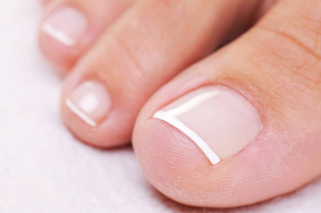 Nail Problems