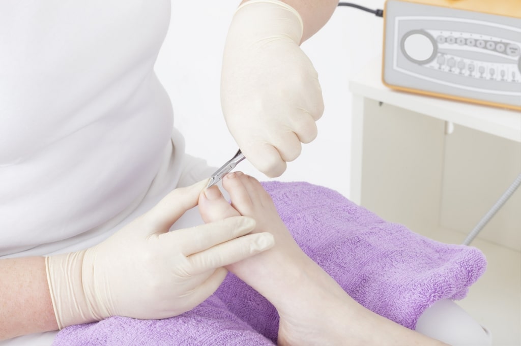 Toenail Treatments & Surgery
